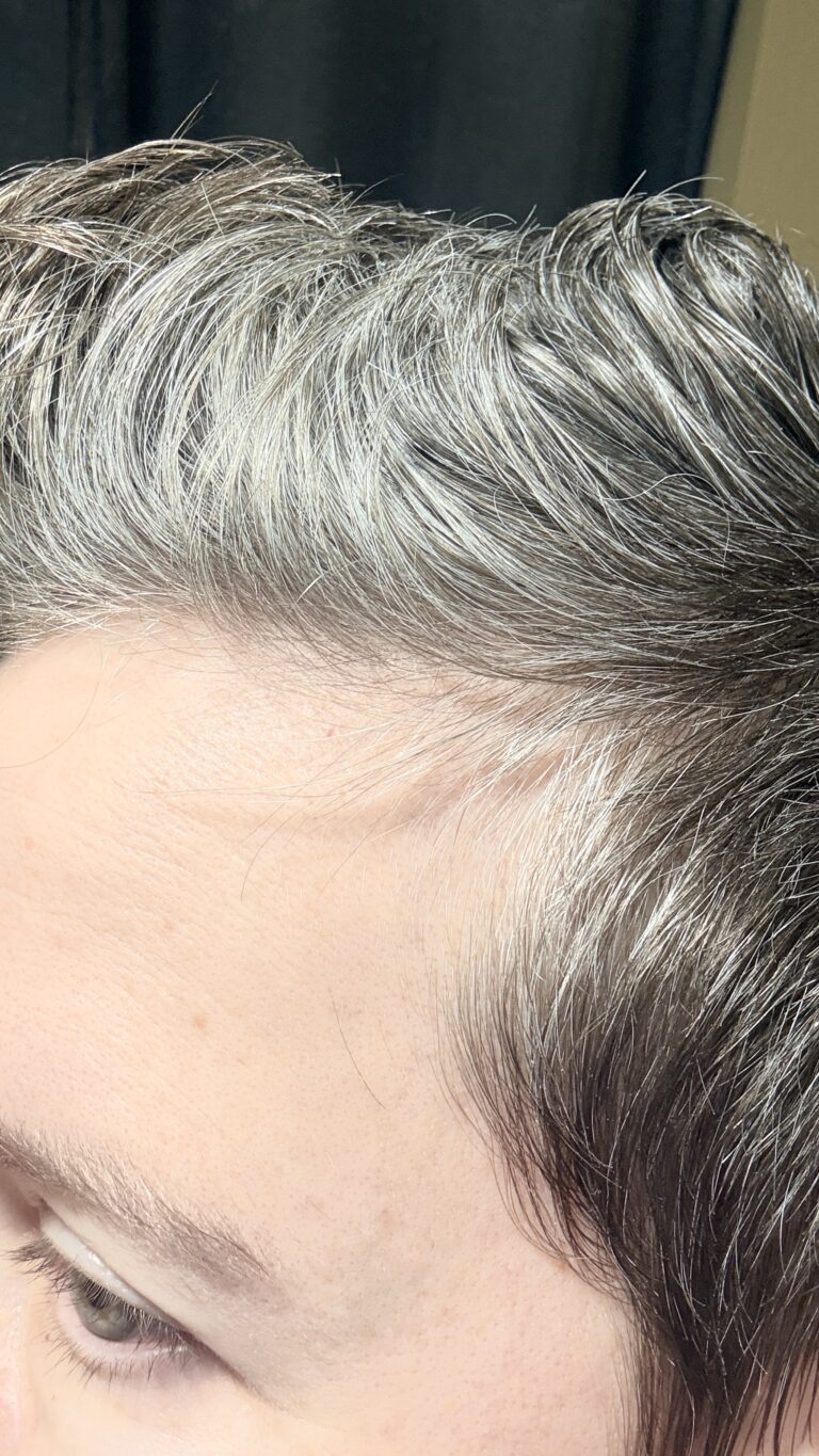 hair thinning after 50