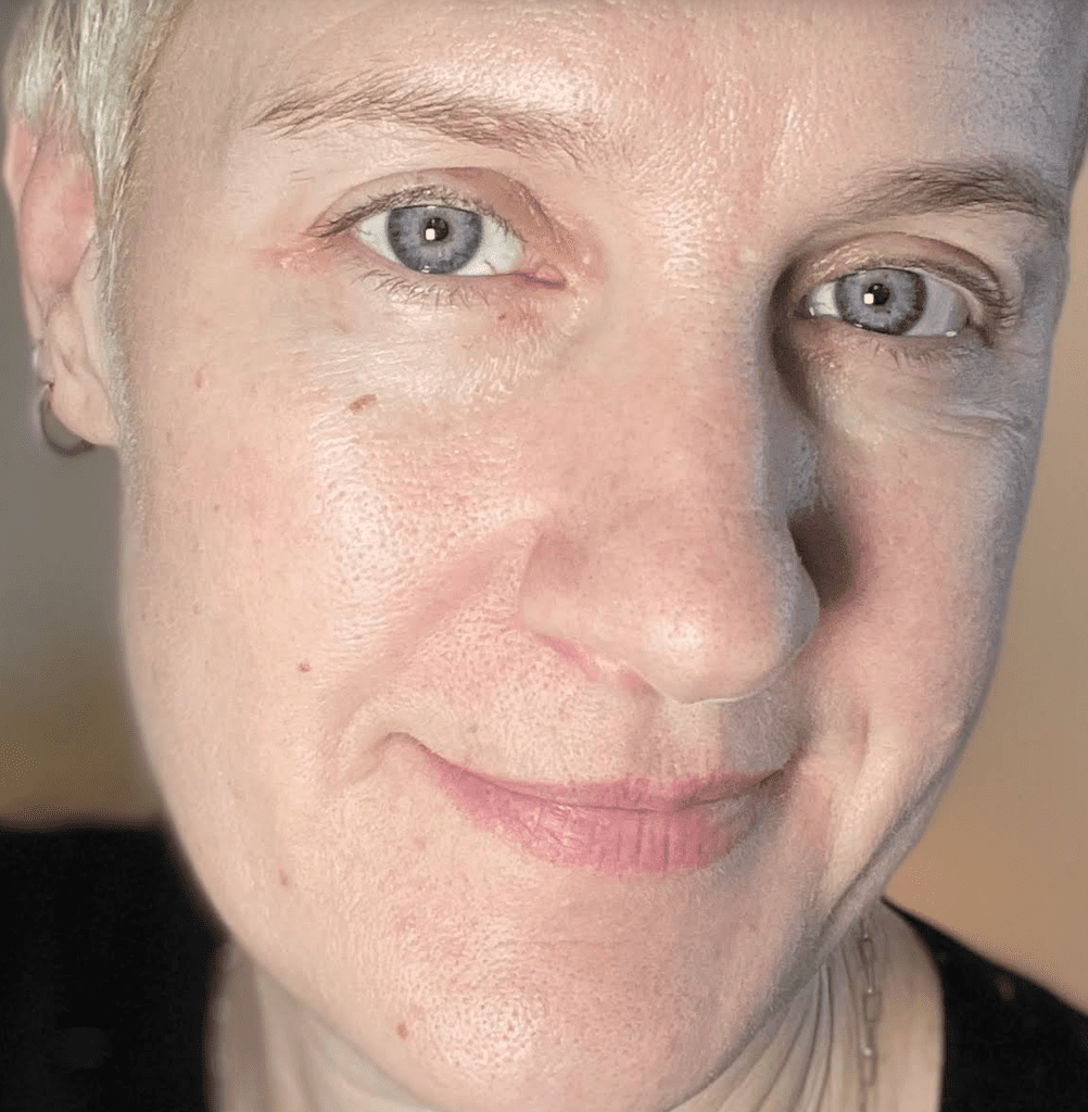 Skincare after 50 Before 