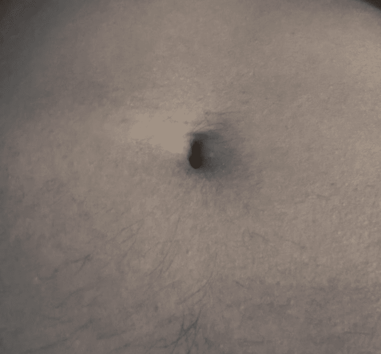 Cortisol belly fat as we age