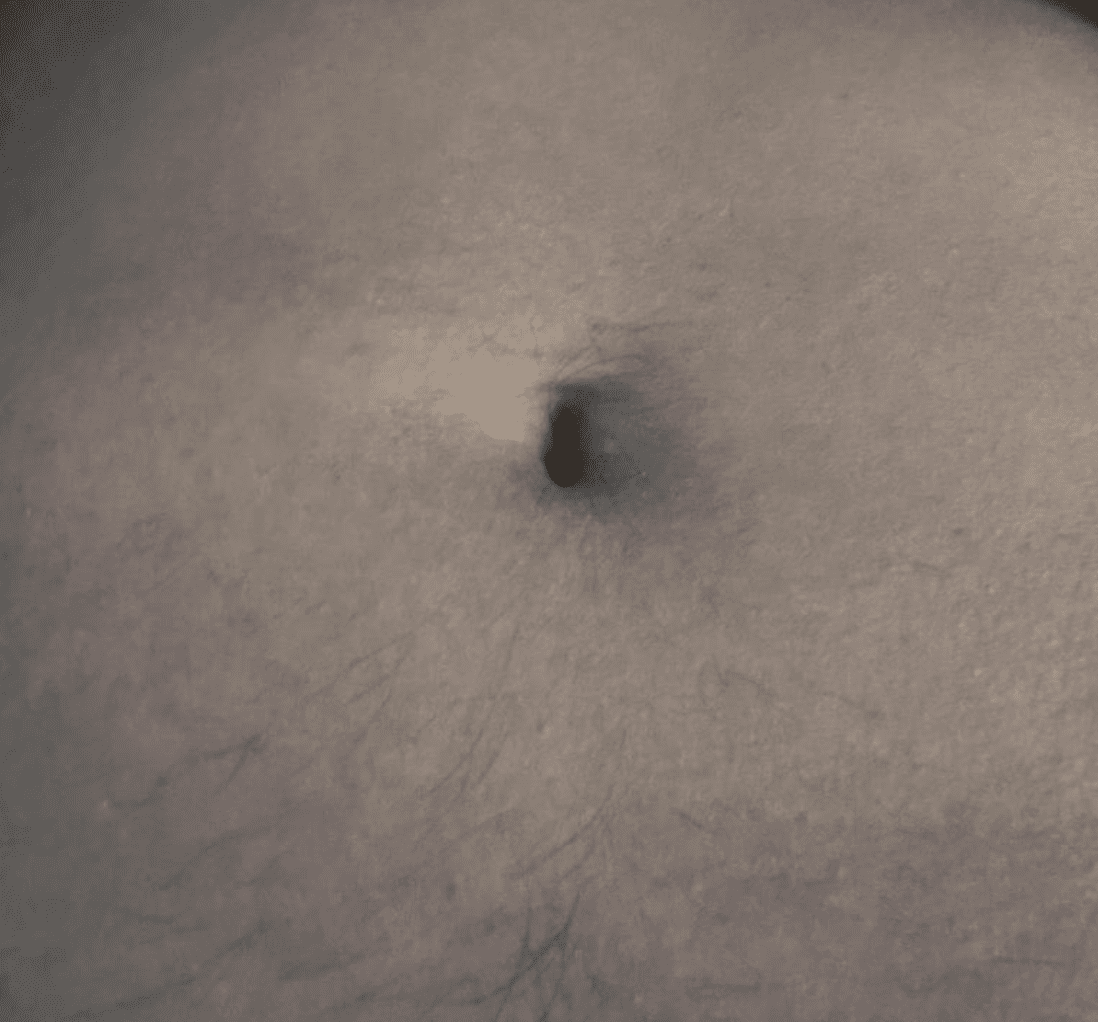 Cortisol belly fat as we age